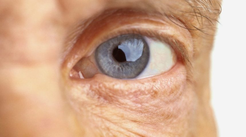 Acidentes oculares causados na terceira idade