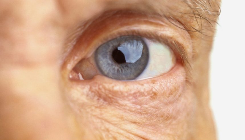 Acidentes oculares causados na terceira idade