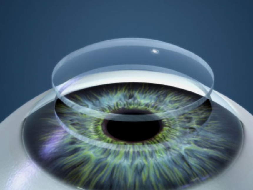 Bancos de olhos ou bancos de tecidos oculares