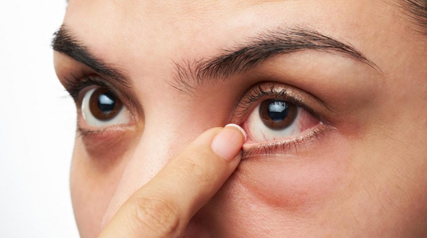 10 dicas úteis para evitar a alergia ocular