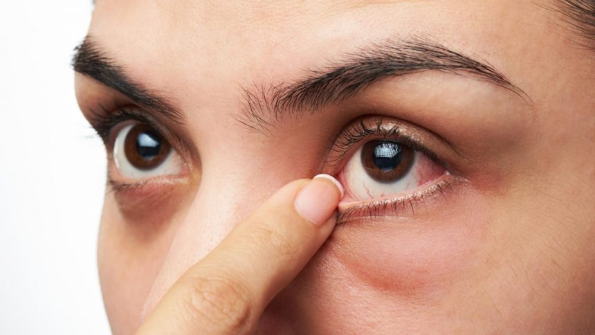 10 dicas úteis para evitar a alergia ocular