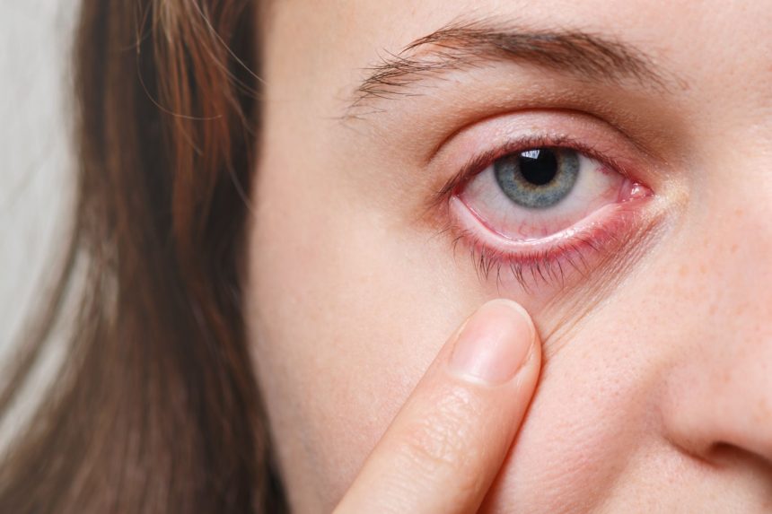 As doenças oculares surgem de acordo com cada região dos olhos