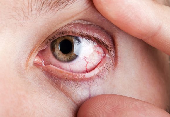 A importância dos exames periódicos para manter a saúde ocular