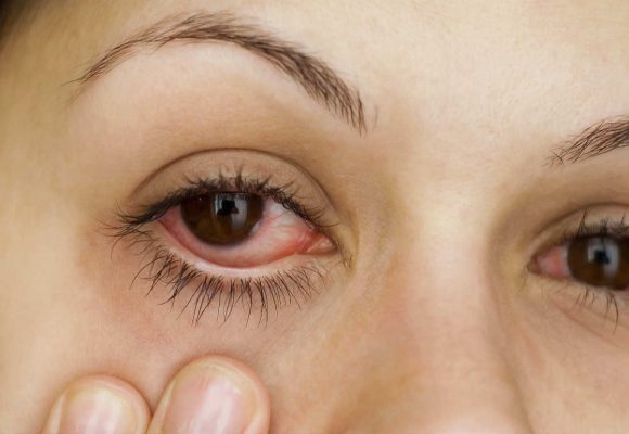 Alergias oculares comuns do outono