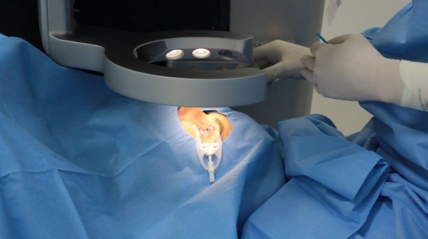 Saiba mais sobre o Streamlight – nova técnica de cirurgia refrativa a laser